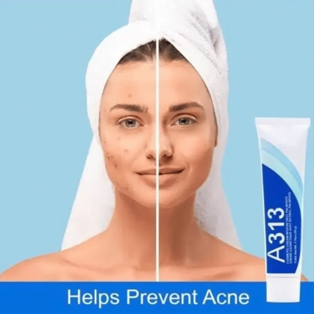 A313 Retinol Cream 50g - Image 3