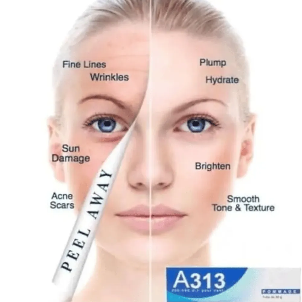 A313 Retinol Cream 50g - Image 4