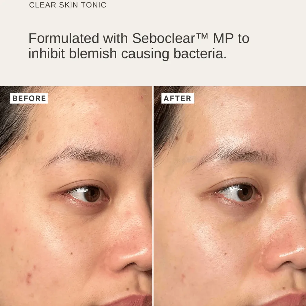 Alpha-H Blemish Duo - Image 3