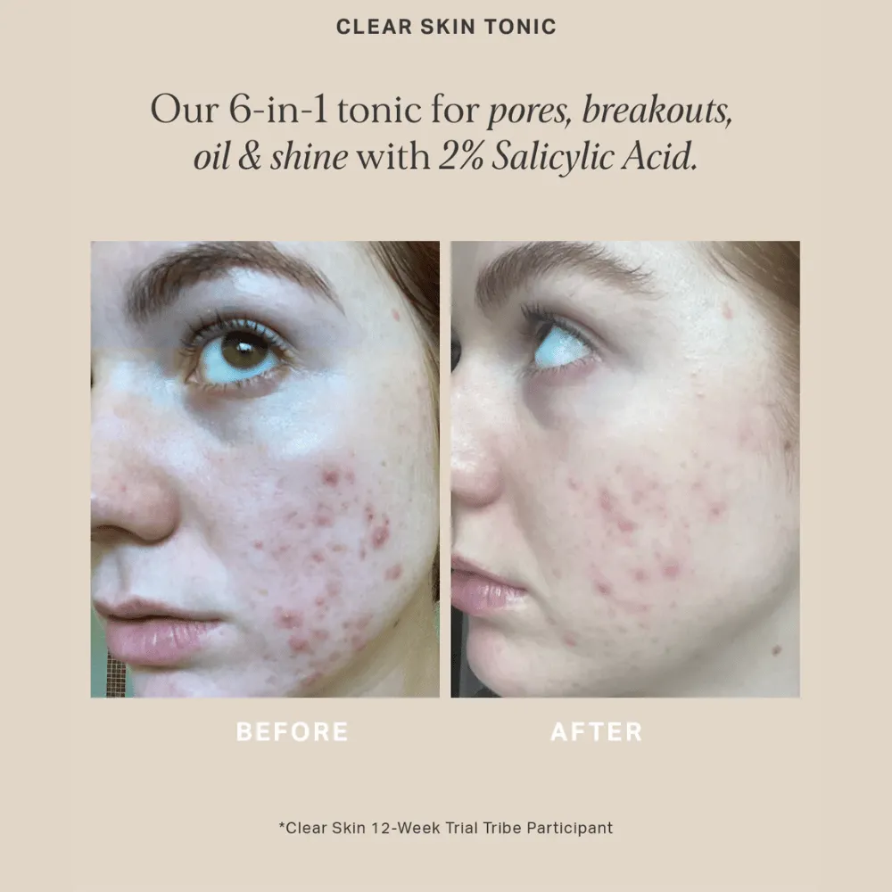 Alpha-H Clear Skin Tonic 30ml - Image 5