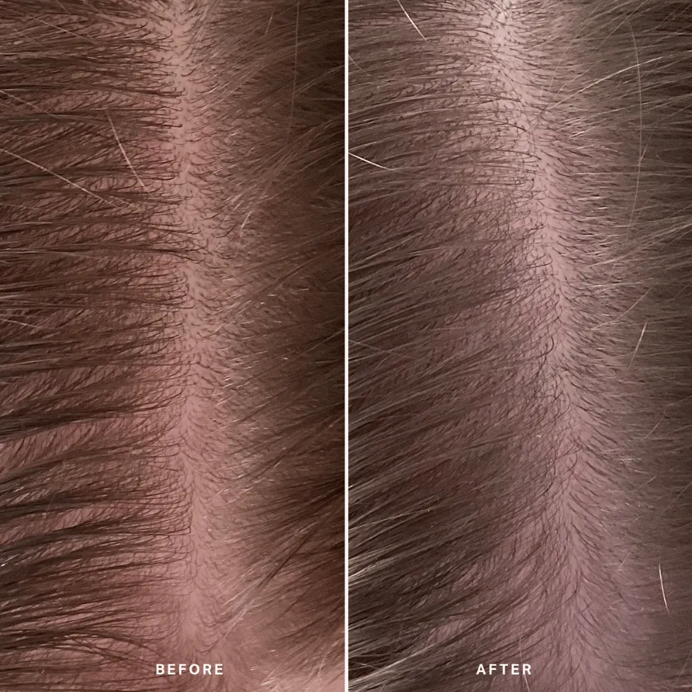 Alpha-H Healthy Scalp Exfoliating Treatment 100ml - Image 8