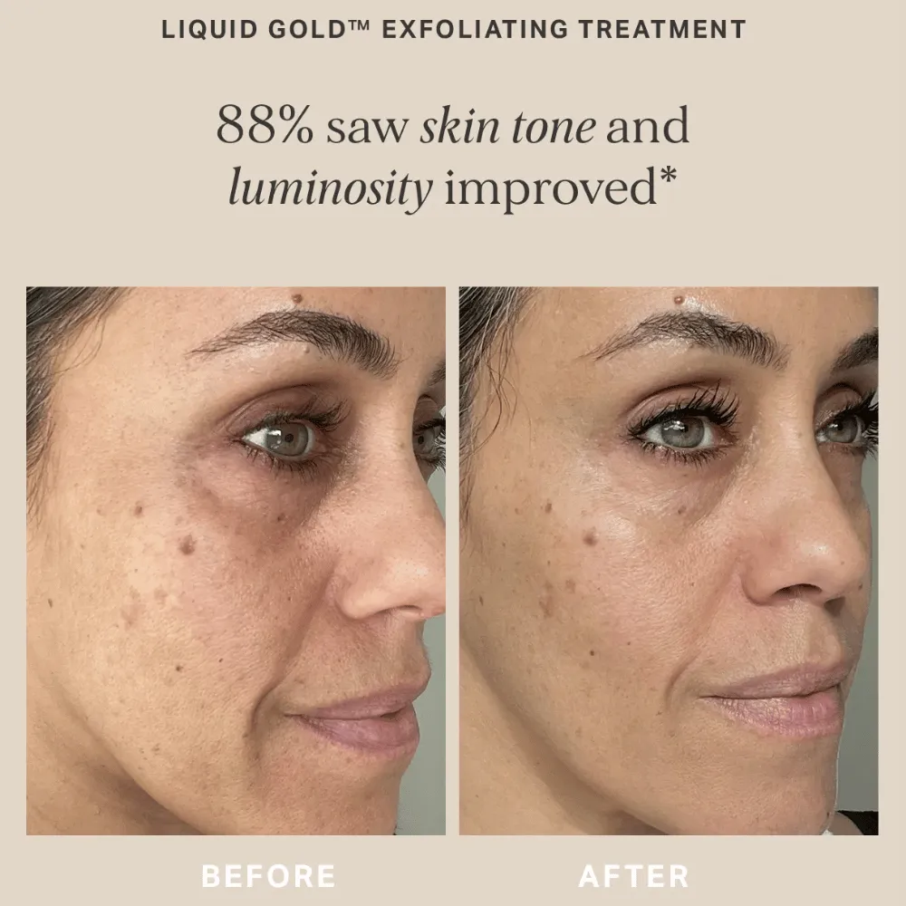 Alpha-H Liquid Gold with 5% Glycolic Acid 200ml - Image 5