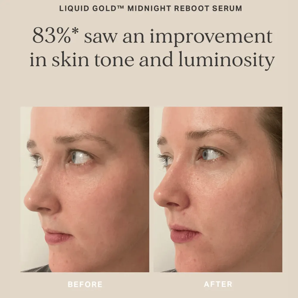 Alpha-H Midnight Reboot Serum 10ml - Image 3