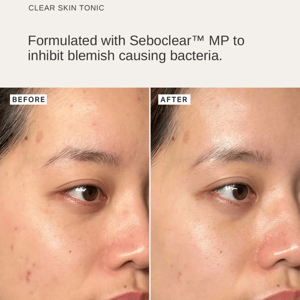 Alpha-H Peri & Menopause Skin Kit - Image 3