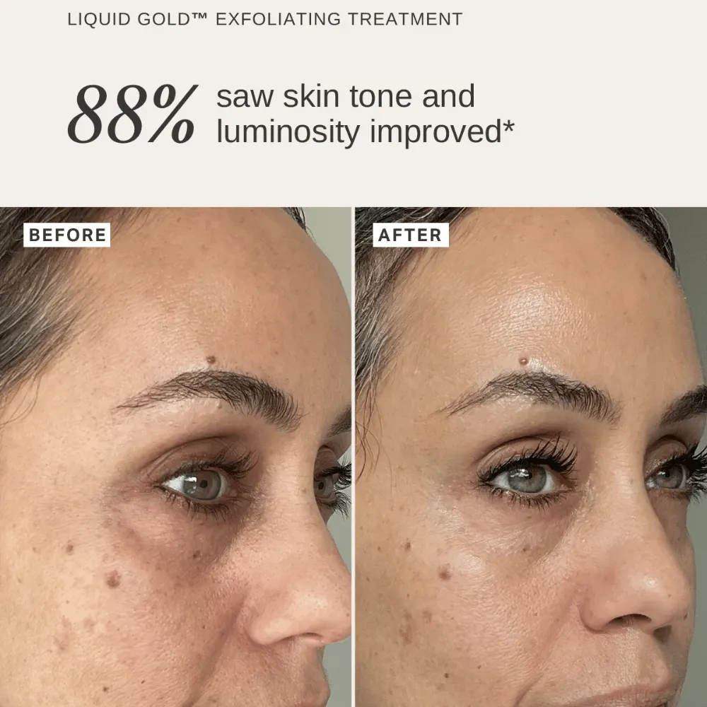 Alpha-H Plump & Glow Duo - Image 3