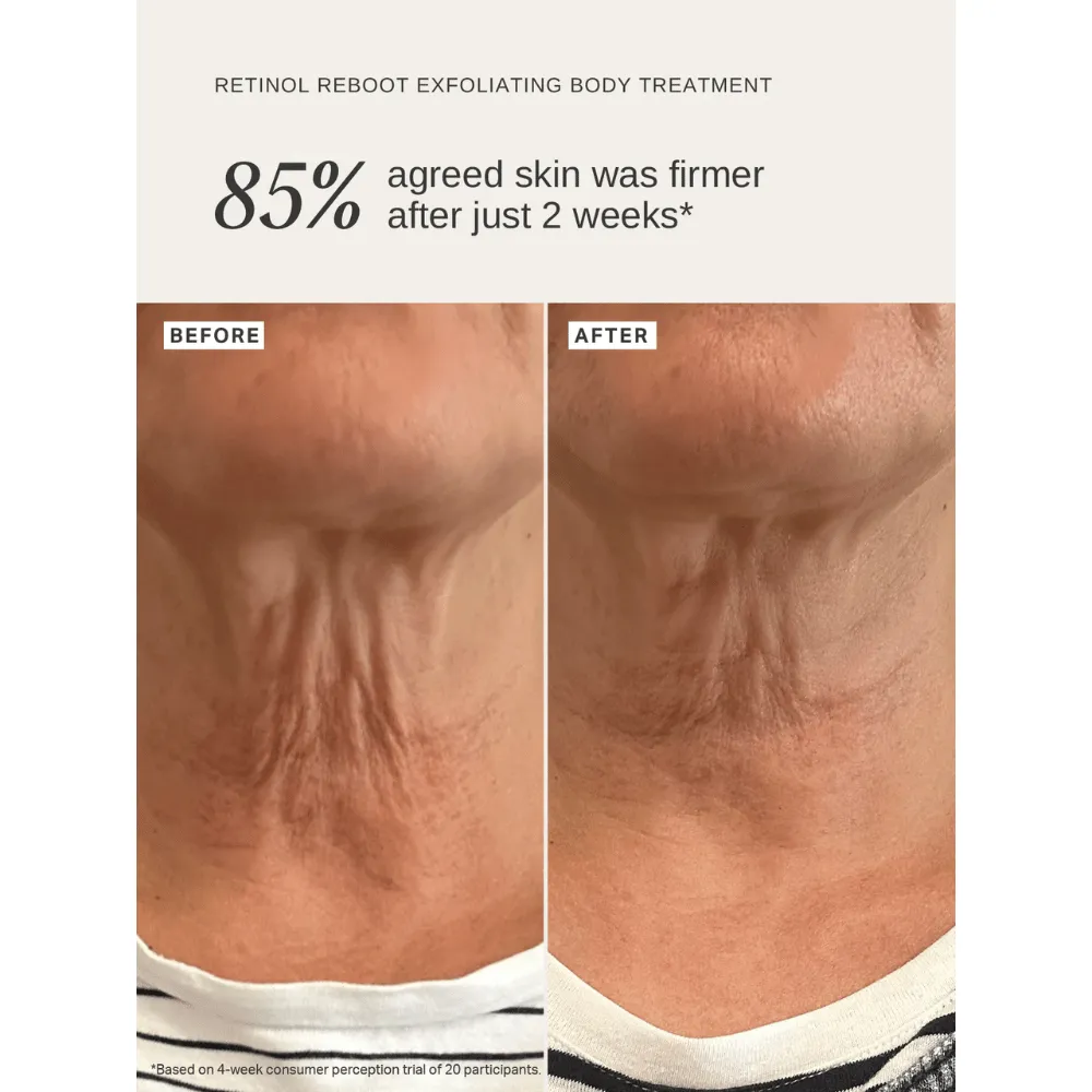 Alpha-H Retinol Reboot Exfoliating Body Treatment 120ml - Image 10