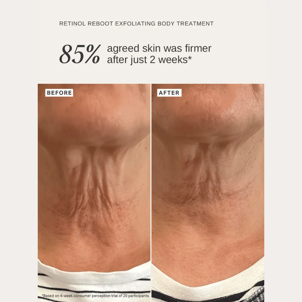 Alpha-H Retinol Reboot Exfoliating Body Treatment 120ml - Image 8