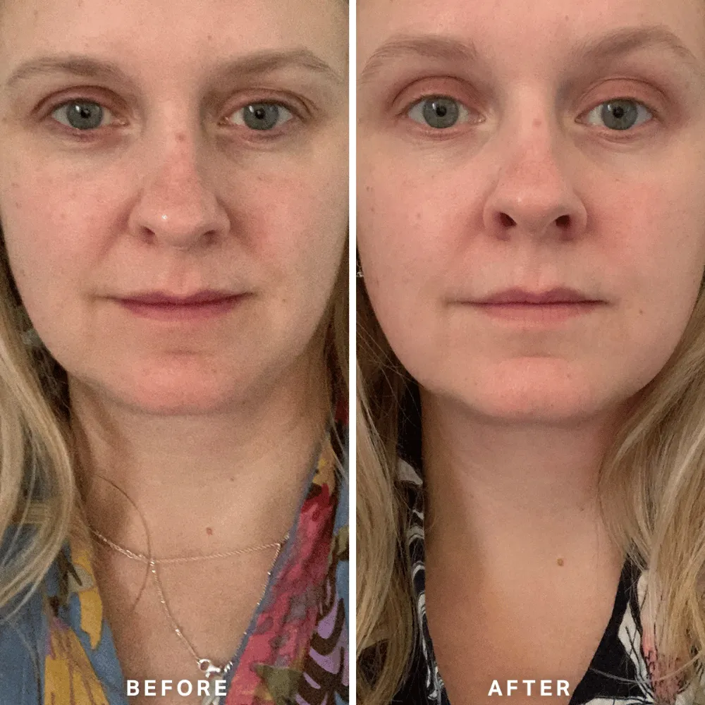 Alpha-H Vitamin A Serum 25ml - Image 6