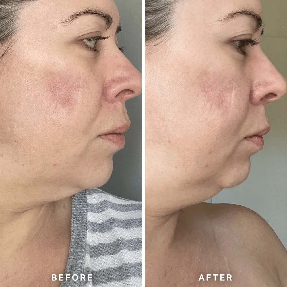 Alpha-H Vitamin A Serum 25ml - Image 7