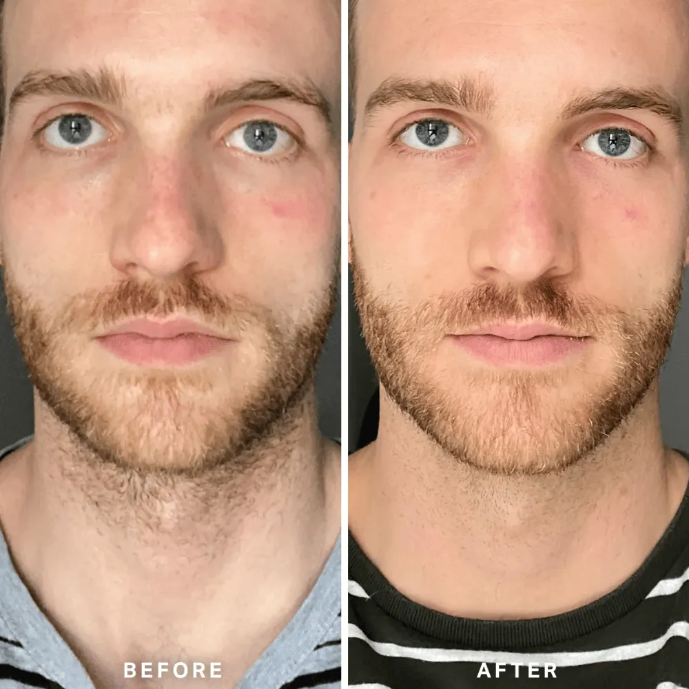 Alpha-H Vitamin B Serum with 5% Niacinamide 10ml - Image 6