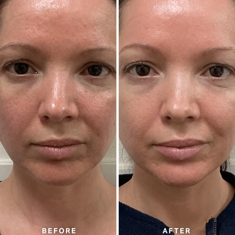 Alpha-H Vitamin B Serum with 5% Niacinamide 10ml - Image 8