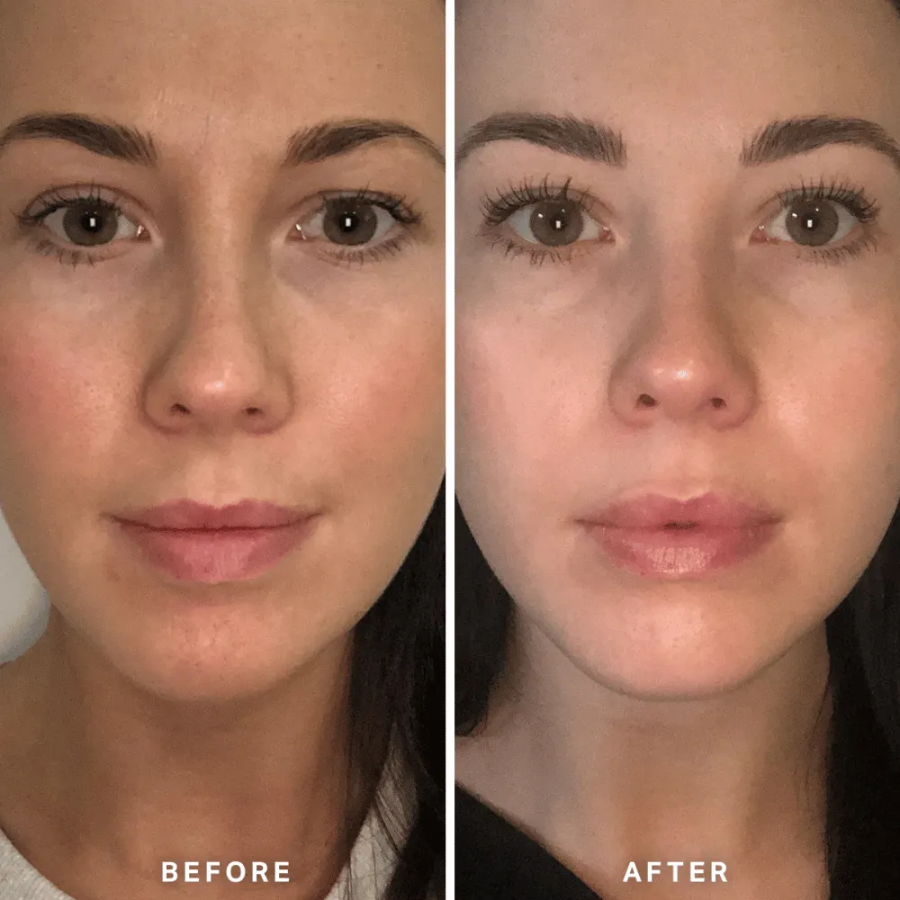 Alpha-H Vitamin B Serum 25ml - Image 9