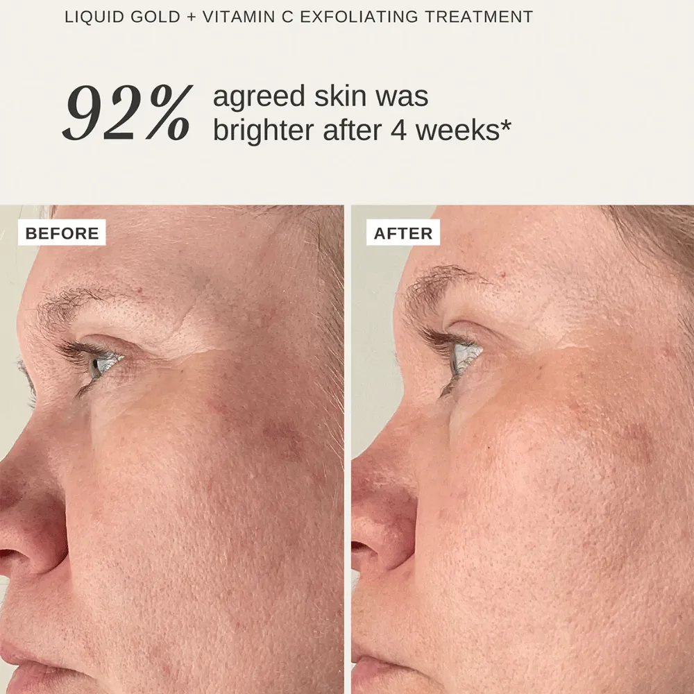 Alpha-H Vitamin C Duo - Image 3