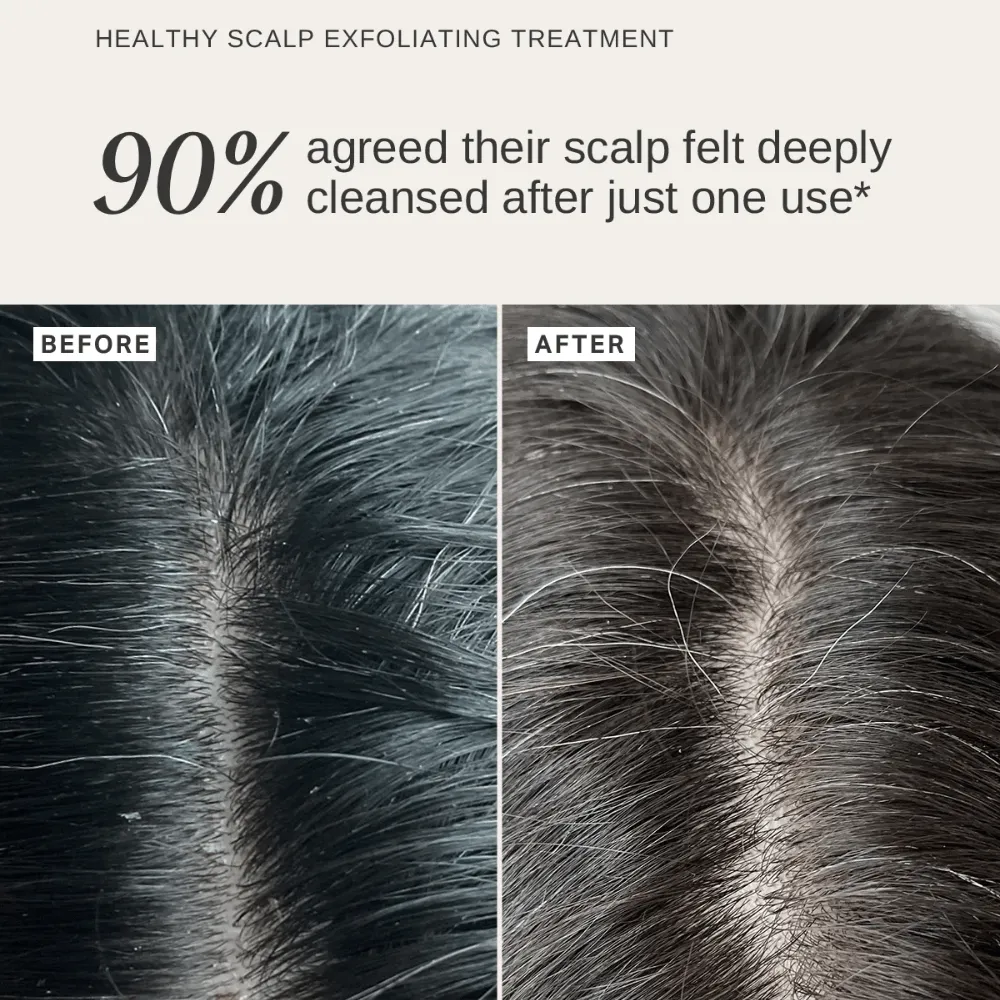 Alpha-H Scalp & Body Trio - Image 8