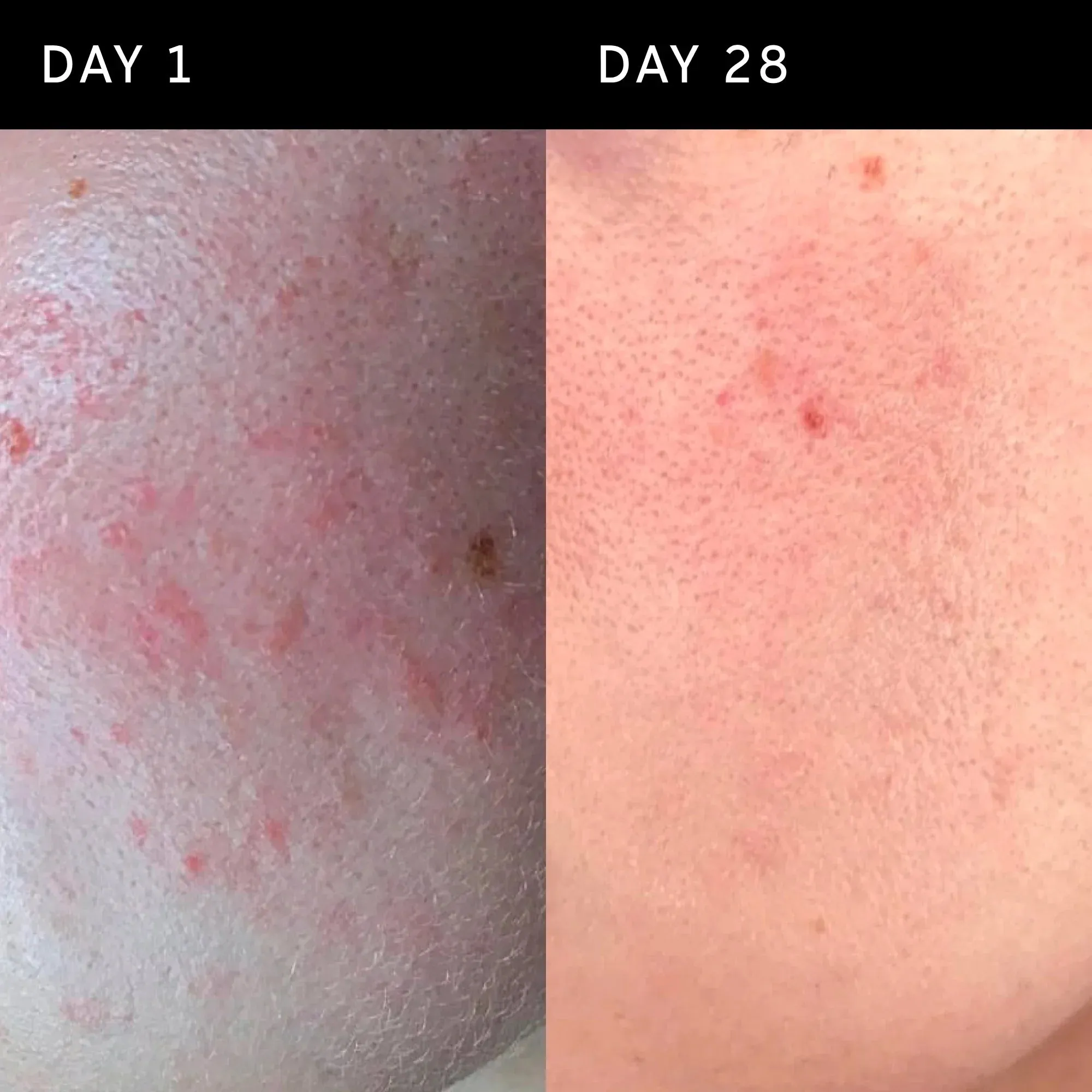 The Inkey List Ectoin Hydro-Barrier Serum - 30ml - Image 6