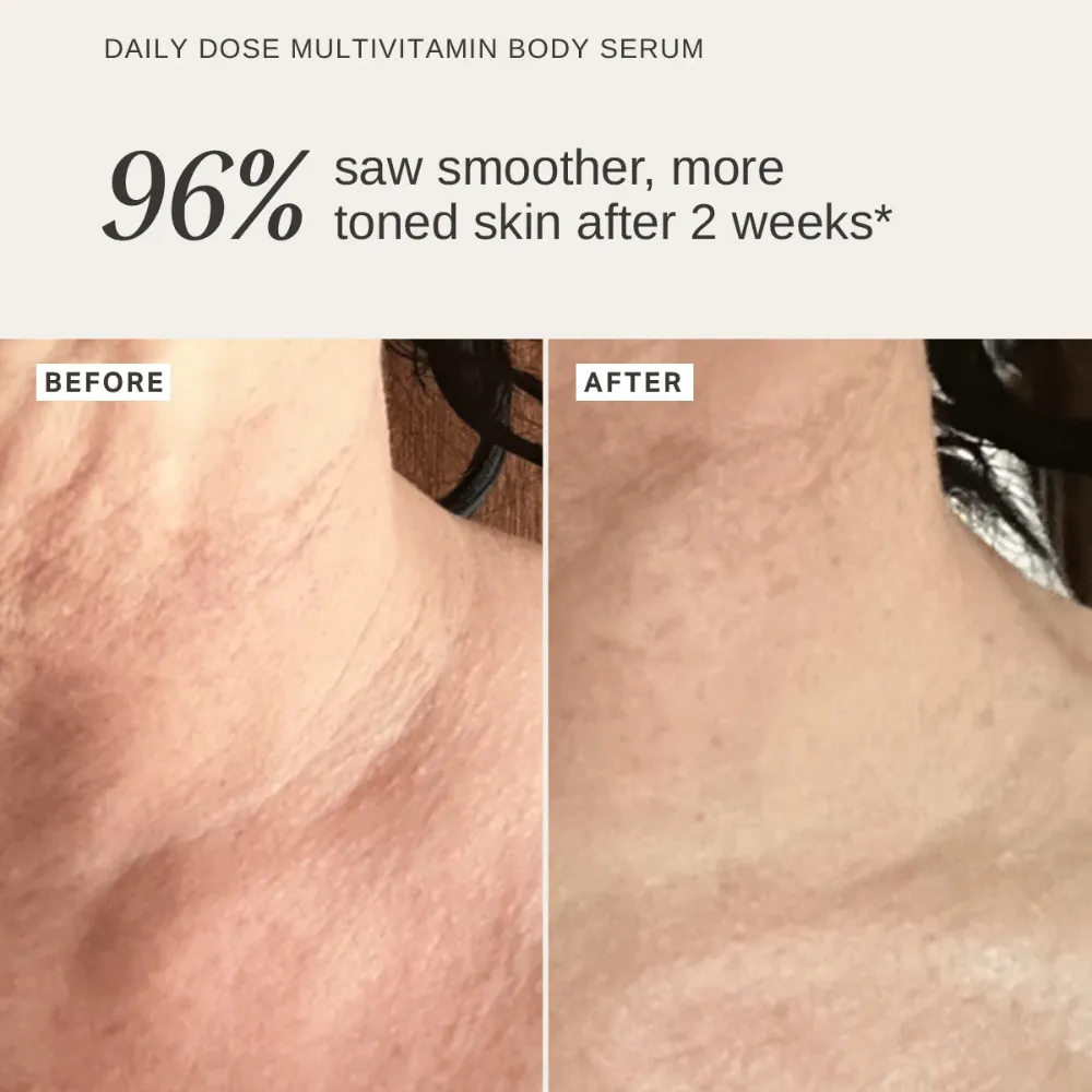 Alpha-H Firming Body Care Duo - Image 4