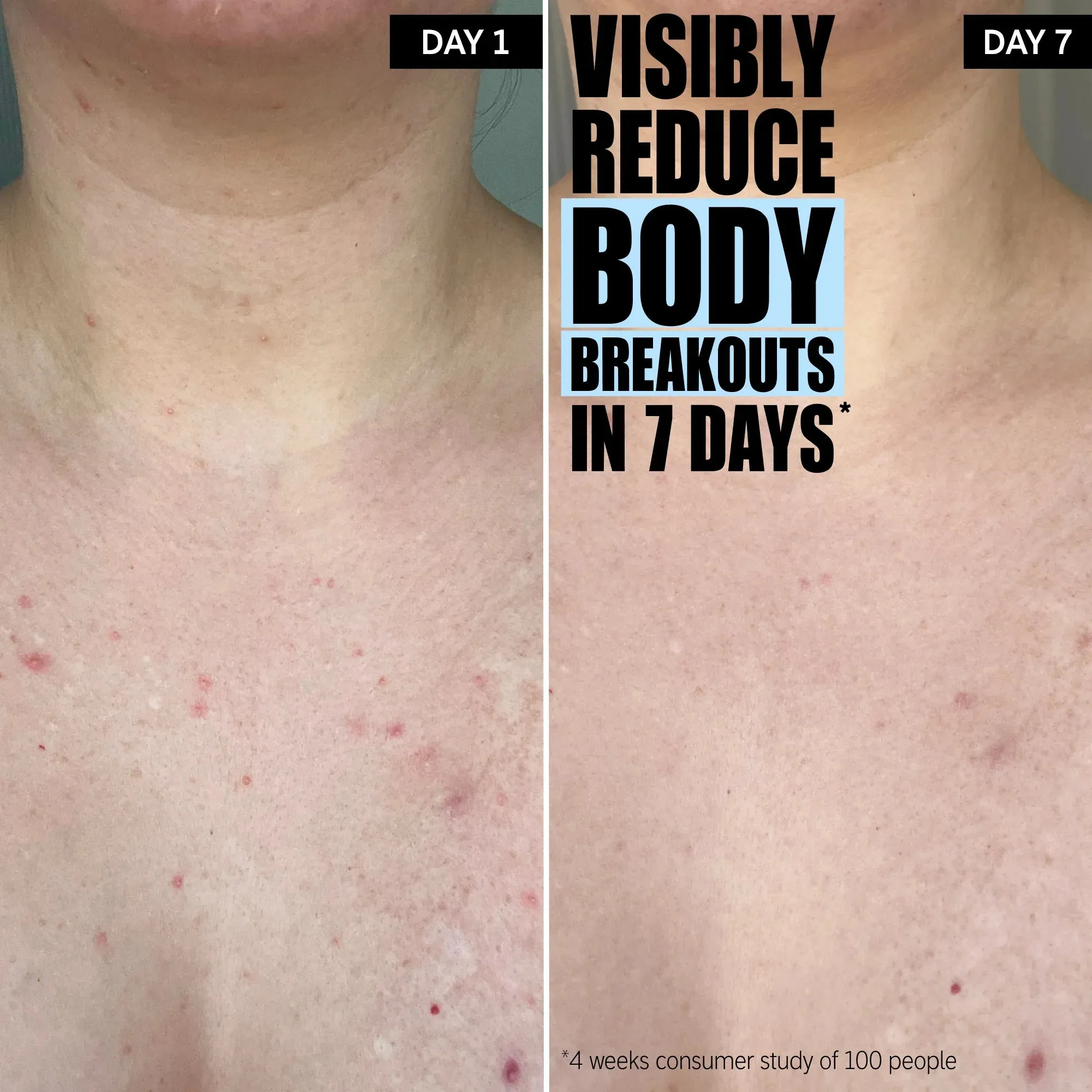 The Inkey List Glycolic Acid Exfoliating Body Stick -45g - Image 7