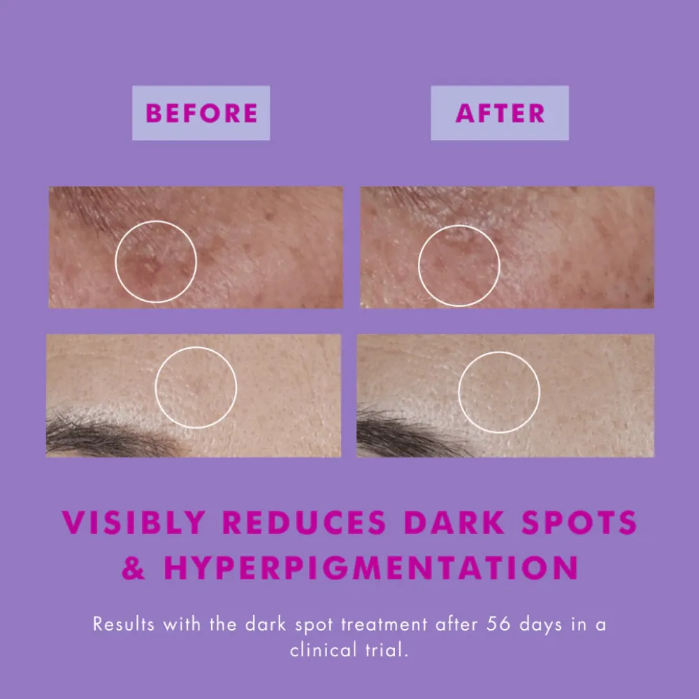 Hello Sunday The One That Makes You glow (Dark Spot Serum) - 30ml - Image 3