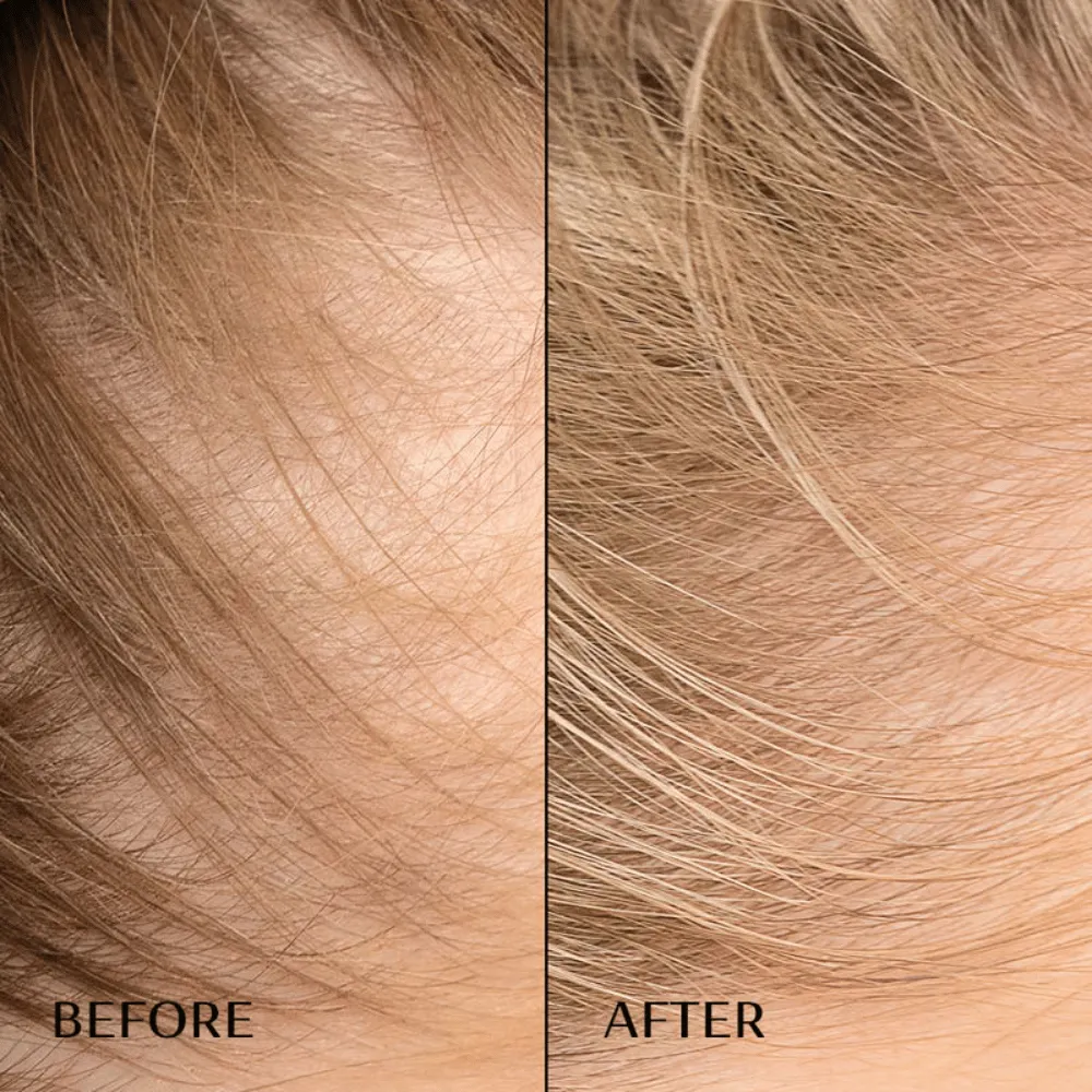 M2 BEAUTÉ Hair Activating Serum 30ml - Image 2