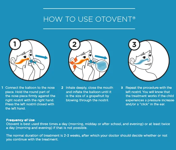 Otovent Glue Ear Balloon Nasal Device - Image 2