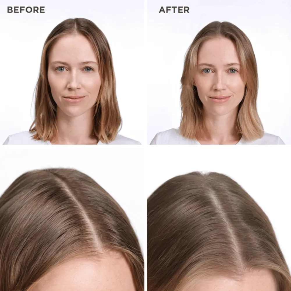 Phyto SOFTNESS Dry Shampoo 75ml - Image 3