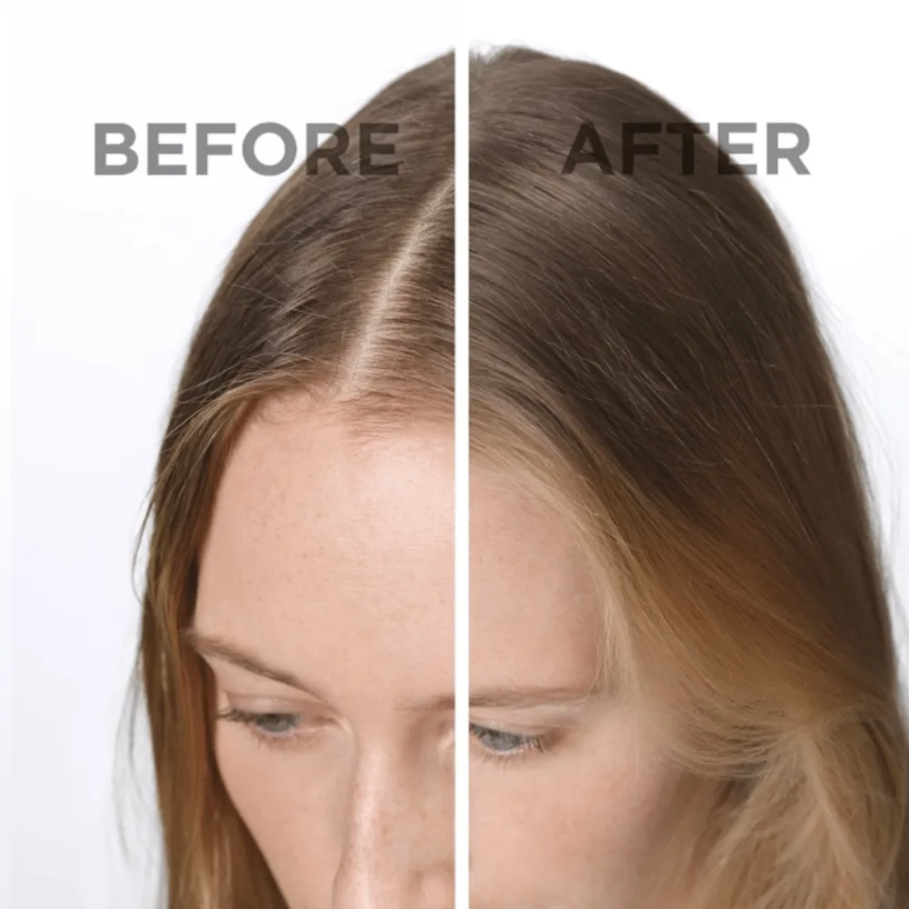 Phyto SOFTNESS Dry Shampoo 75ml - Image 5