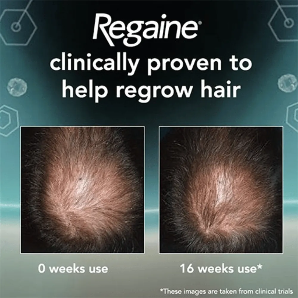 Regaine (minoxidil) 5% Foam For Men (1 month Supply) - 60g - Image 5