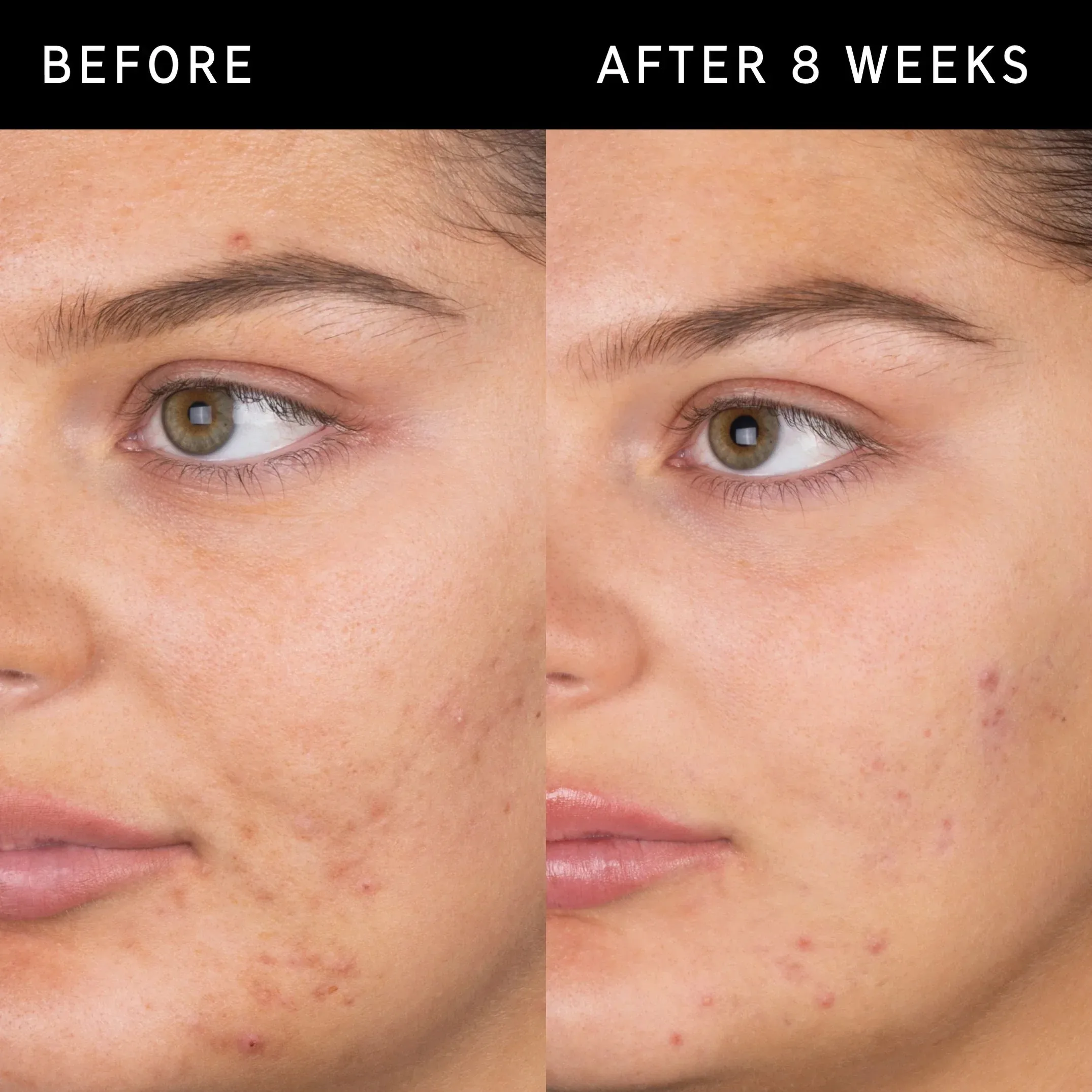 The Inkey List Salicylic Acid Cleanser - 150ml - Image 7