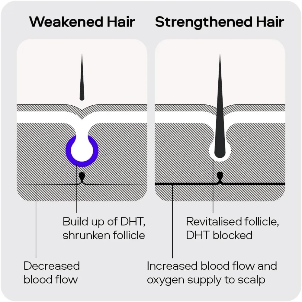 Sons Complete Hair Loss Treatment. Minoxidil 5%-3 Month Supply - Image 5