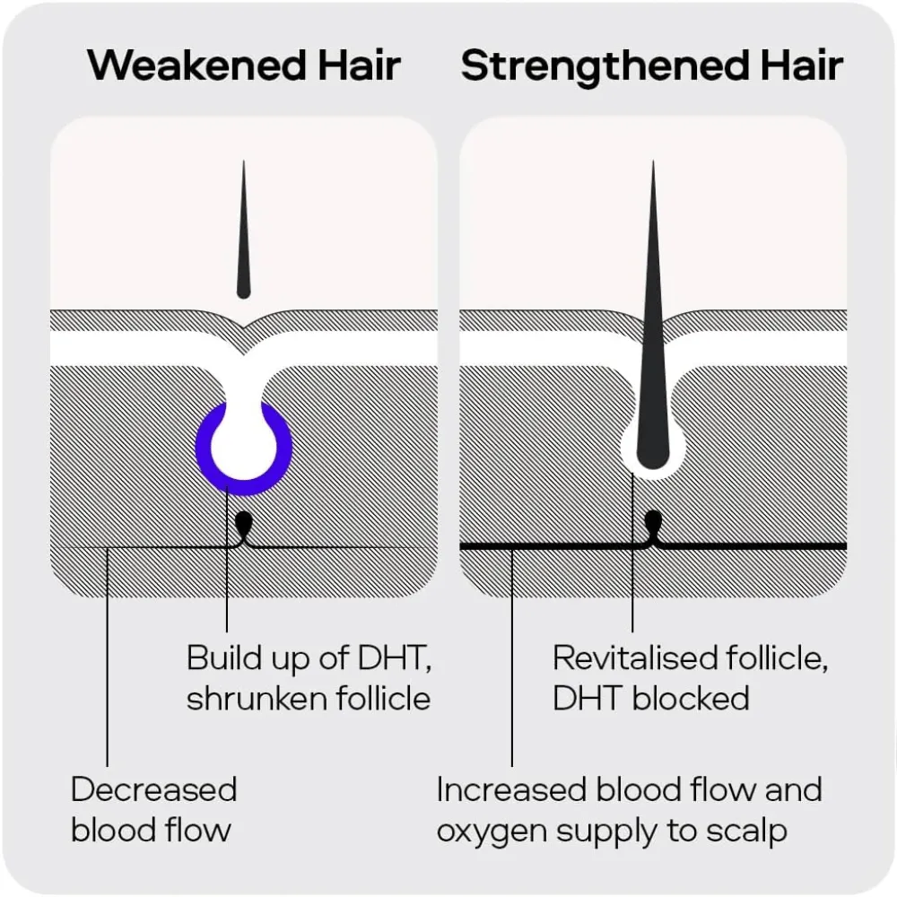 Sons Hair Growth Shampoo For Men- 3 Month Supply - Image 3
