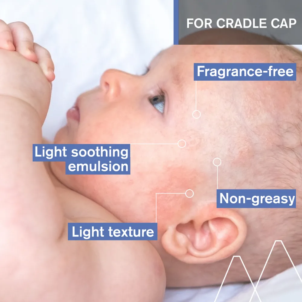 Uriage Baby's 1st Soothing Cradle Cap Care Regulating Cream 40ml - Image 3